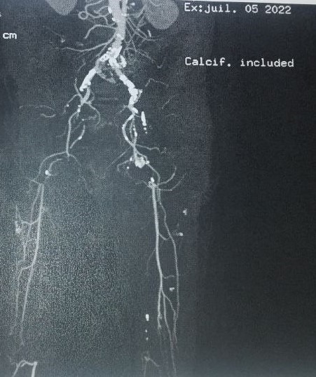 image of a circulatory system.